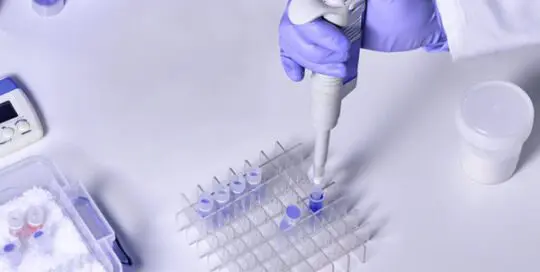 Post Market Performance Follow-up Under the IVDR