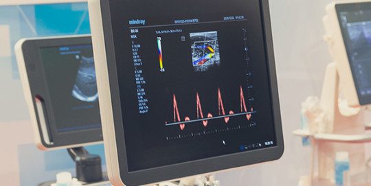 Addressing the Regulatory Challenges with Software as a Medical Device in EU MDR