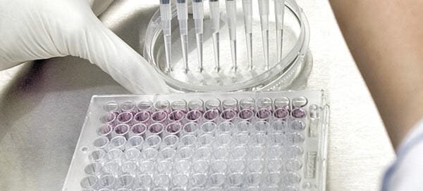 How Does the EU IVDR Impact the IVD Industry? EU IVDR Key Changes