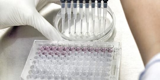 The Impact of the EU IVDR on QMS Requirements