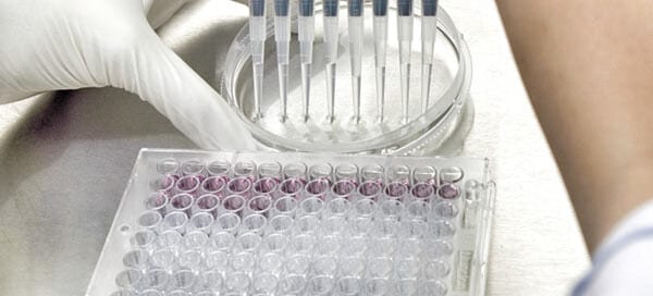 The Impact of the EU IVDR on QMS Requirements