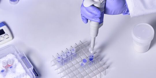 Post Market Performance Follow-up Under the IVDR