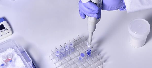 Post Market Performance Follow-up Under the IVDR