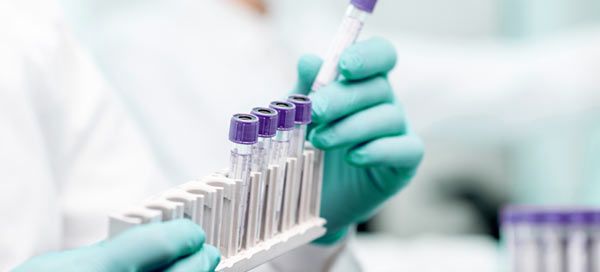 Reclassification of Devices Under IVDR