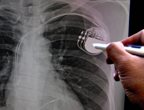 Regulatory Intelligence Consulting Support for an EU Medical Device Manufacturer