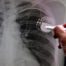 Regulatory Intelligence Consulting Support for an EU Medical Device Manufacturer - Feature